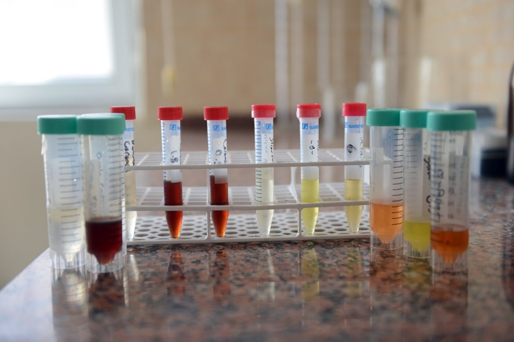 Elektronik sigarada gizli tehlike: Aroma