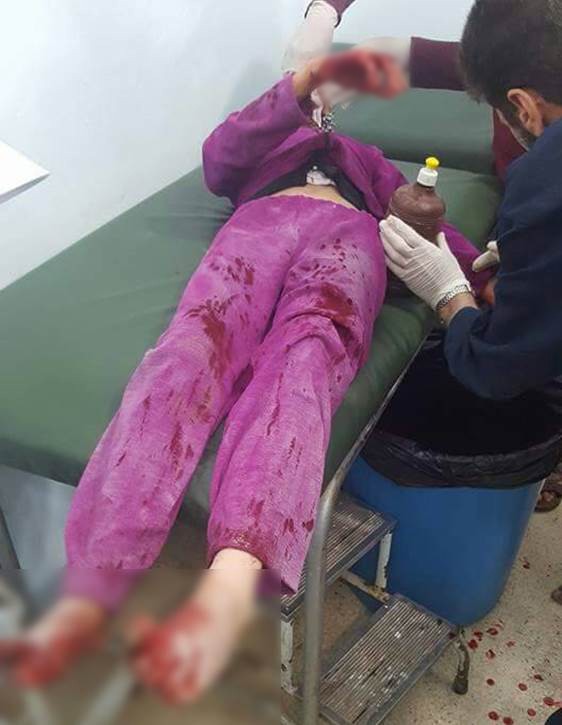 PKK/PYD Suriye’de sivilleri hedef aldı: 4 ölü, 20 yaralı