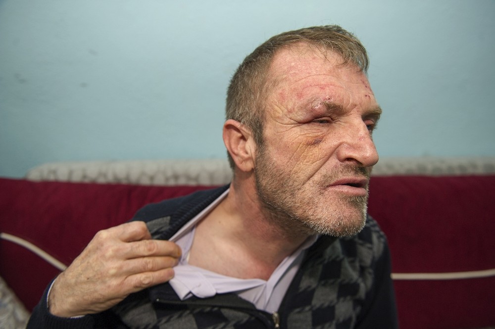 (Özel Haber) Görme engelli adamın ellerini ve ayaklarını bağlayarak darp sonra gasp ettiler
