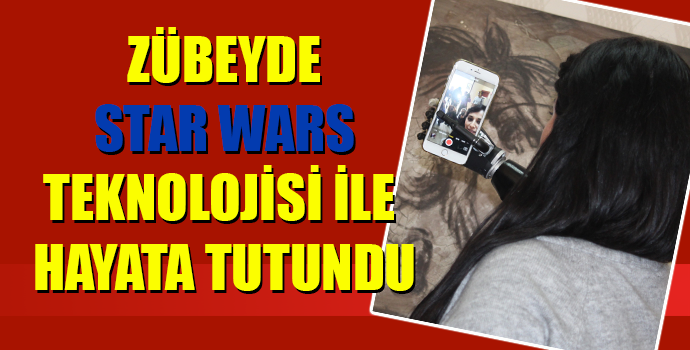 ZÜBEYDE, STAR WARS TEKNOLOJİSİ İLE HAYATA TUTUNDU