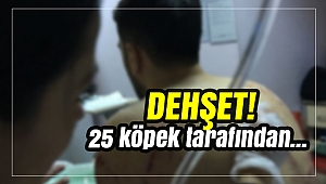 Ankara’da köpek dehşeti! 25 köpek üniversiteli gence saldırdı
