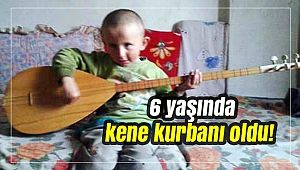 Elbisesine yapıştı; sonu oldu