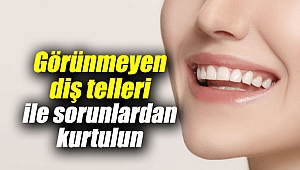 Görünmeyen diş telleri ile sorunlardan kurtulun