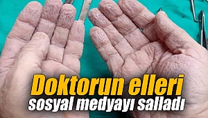 Doktorun elleri sosyal medyayı salladı