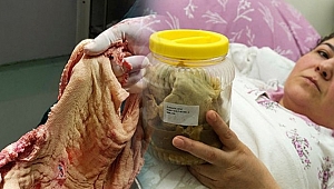 3 yıl önce ameliyatta karnında unutuldu! Tam 1.8 kilo