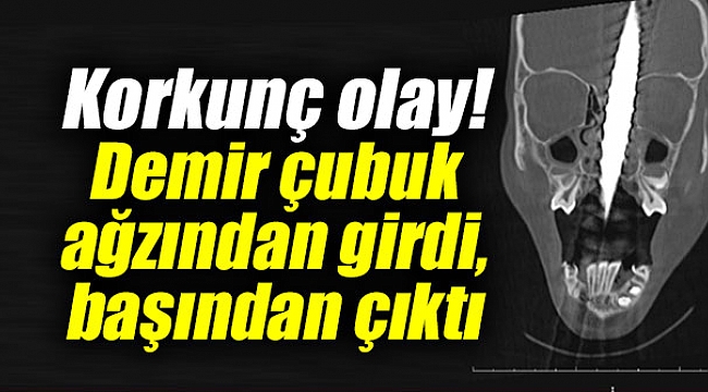 Korkunç olay!