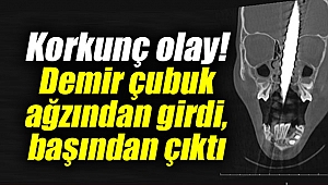 Korkunç olay!