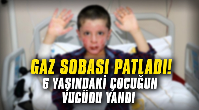Gaz sobası patladı! 6 yaşındaki çocuğun vücudu yandı...
