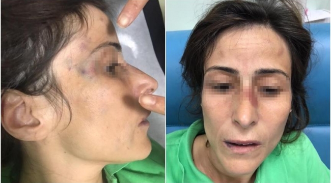 Eşini darbeden doktora hapis cezası