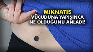 Mıknatıs vücuduna yapışınca ne olduğunu anladı!