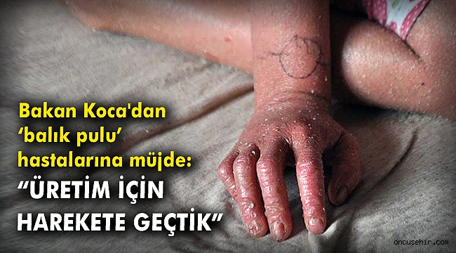 Bakan Koca'dan 'balık pulu' hastalarına müjde: 'Üretim için harekete geçtik'