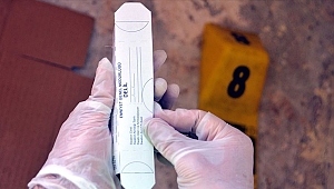 Suçluyu saç kepeği bile ele veriyor!