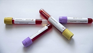 O Bakan yardımcısında coronavirüs tespit edildi