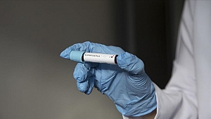 İtalya koronavirüs pençesinde: Ölü sayısı 79'a yükseldi!