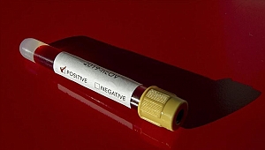 Koronavirüs testi yaptıranlar dikkat