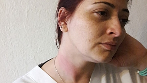 İzmir'de sağlık çalışanına saldırı!