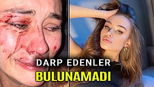 Ukraynalı model yediği dayakla kaldı, tek şüpheli o da serbest!