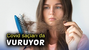Covid saçları da vuruyor