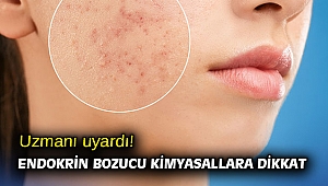 Uzmanı uyardı! Endokrin Bozucu Kimyasallara dikkat