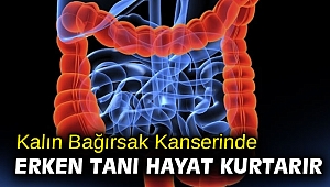 Kalın bağırsak kanserinde erken tanı hayat kurtarır