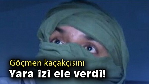 Göçmen kaçakçısını yara izi ele verdi