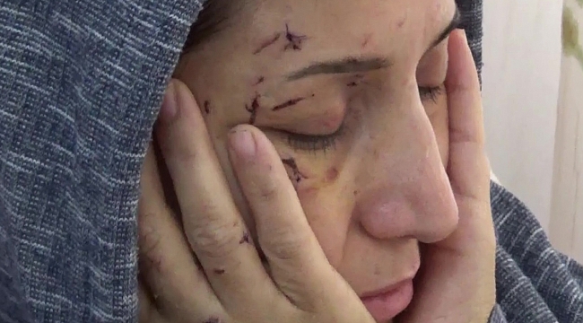 Yeğeni elini öpmedi diye dövdü, yengesini de 50 yerinden bıçakladı