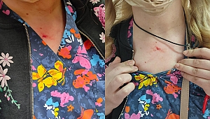 Aşı için gelen kadın, sağlık çalışanını darp etti