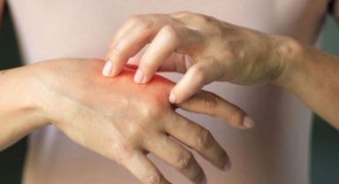 Soğuk yanığına dikkat! Soğuk havalarda güvenli egzersiz nasıl olmalı?