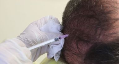 Cildiye profesöründen uyarı: Saçkıran olan bölgeye sarımsak veya jilet sürmeyin