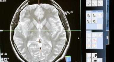 Disleksinin tedavisi ‘özel eğitim’