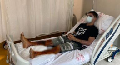 Lavabo açıcı bomba gibi patladı, 21 yaşındaki genç dehşeti yaşadı
