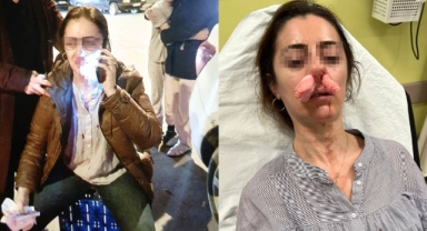 Kocasının sevgilisine benzettiği kadını darbetti, pardon deyip kaçtı