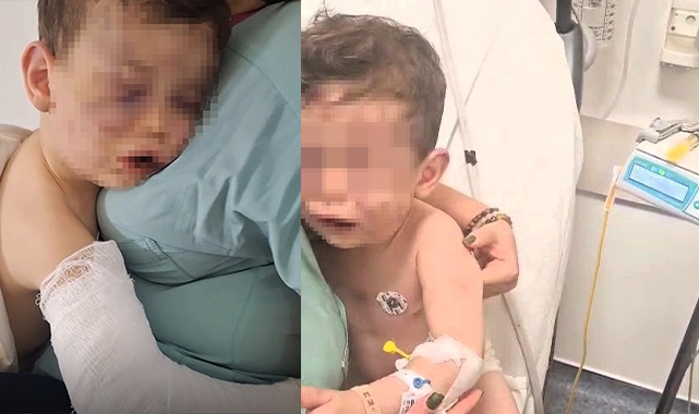 Aren bebeği hastanelik eden caninin yargılandığı davada yeni gelişme!