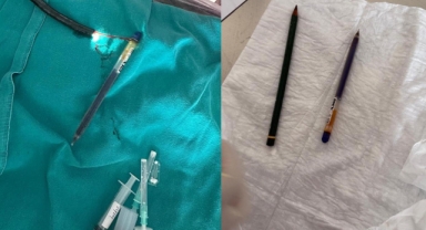 Midesinden endoskopiyle iki kalem çıkarıldı!