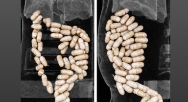 Midesinde uyuşturucu taşıyan şüpheliler tutuklandı