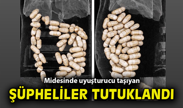 Midesinde uyuşturucu taşıyan şüpheliler tutuklandı